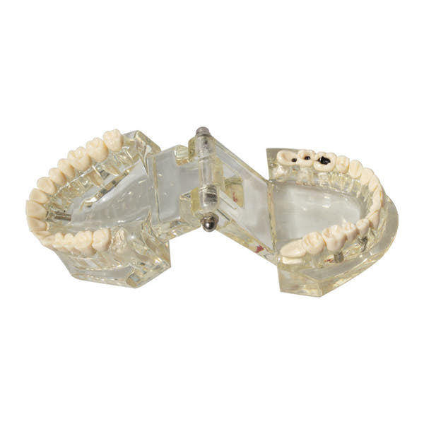 Dental implant restoration model oral teaching model