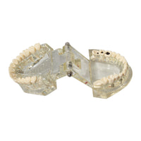 Dental implant restoration model oral teaching model
